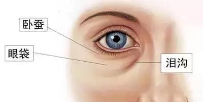 眼袋是什麼，如何治療眼袋—健麗醫美解答
